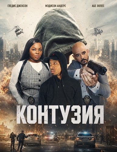 Контузия